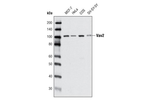  Image 2: Vav Isoform Antibody Sampler Kit
