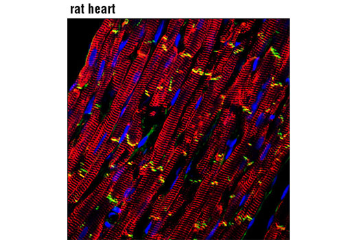 Immunofluorescence Image 1: β-Catenin (L54E2) Mouse mAb (Alexa Fluor® 488 Conjugate)