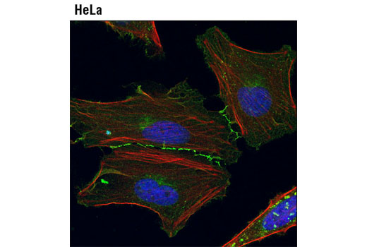 Immunofluorescence Image 2: β-Catenin (L54E2) Mouse mAb (Alexa Fluor® 488 Conjugate)
