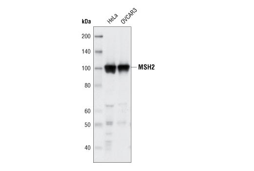 Western Blotting Image 1: MSH2 (3A2) Mouse mAb