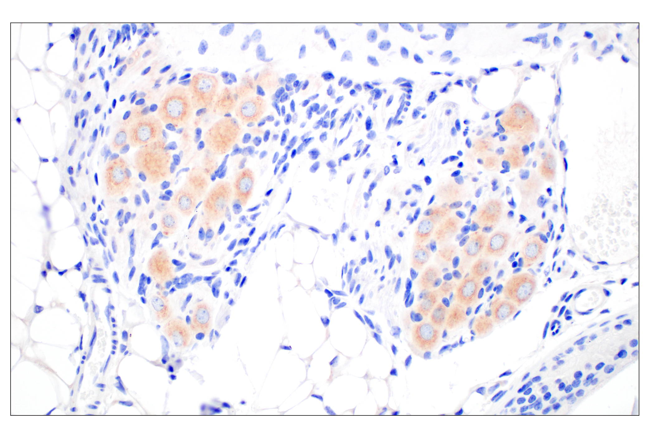 Immunohistochemistry Image 5: BACE1 (F4Z7X) Rabbit mAb