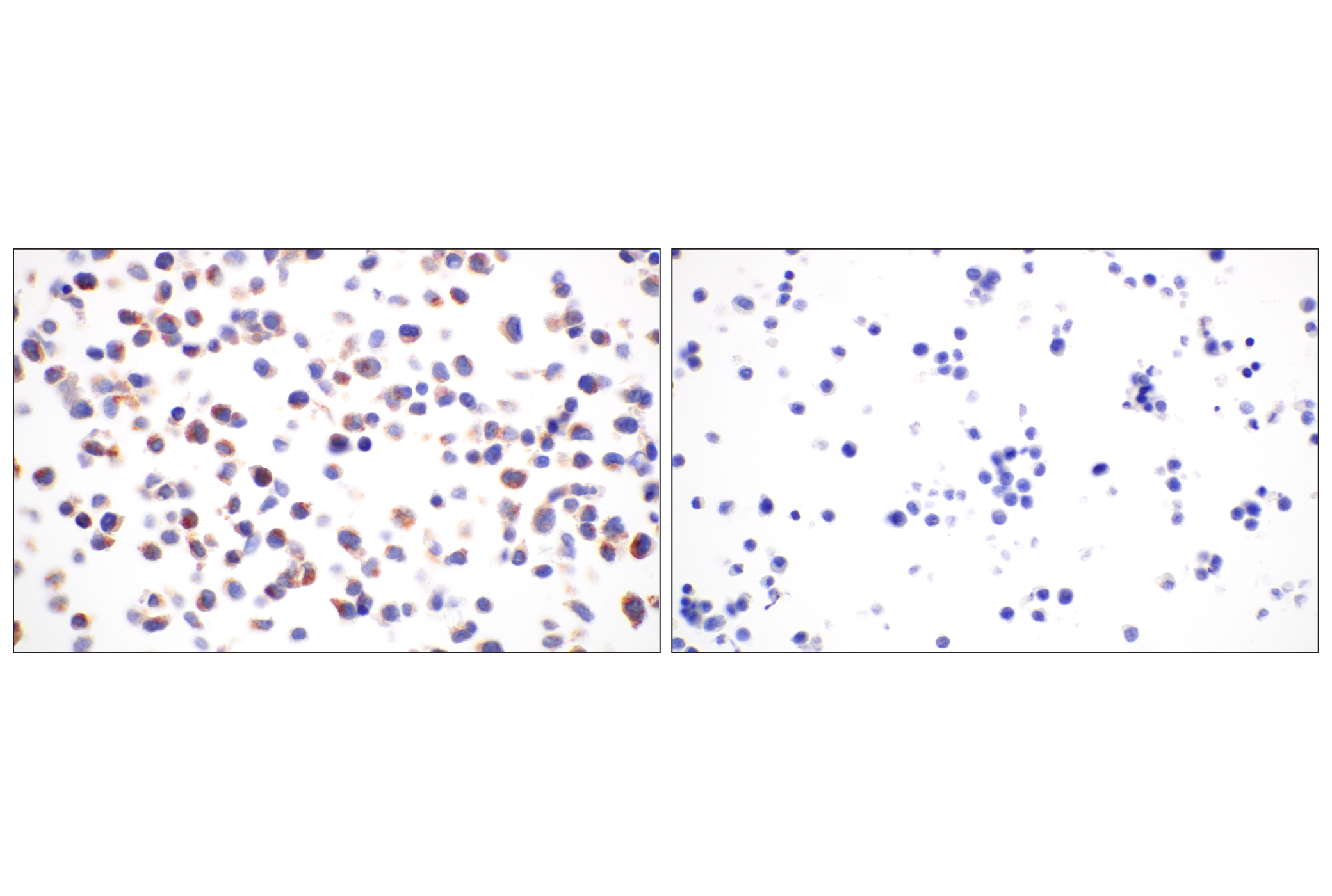 Immunohistochemistry Image 8: BACE1 (F4Z7X) Rabbit mAb