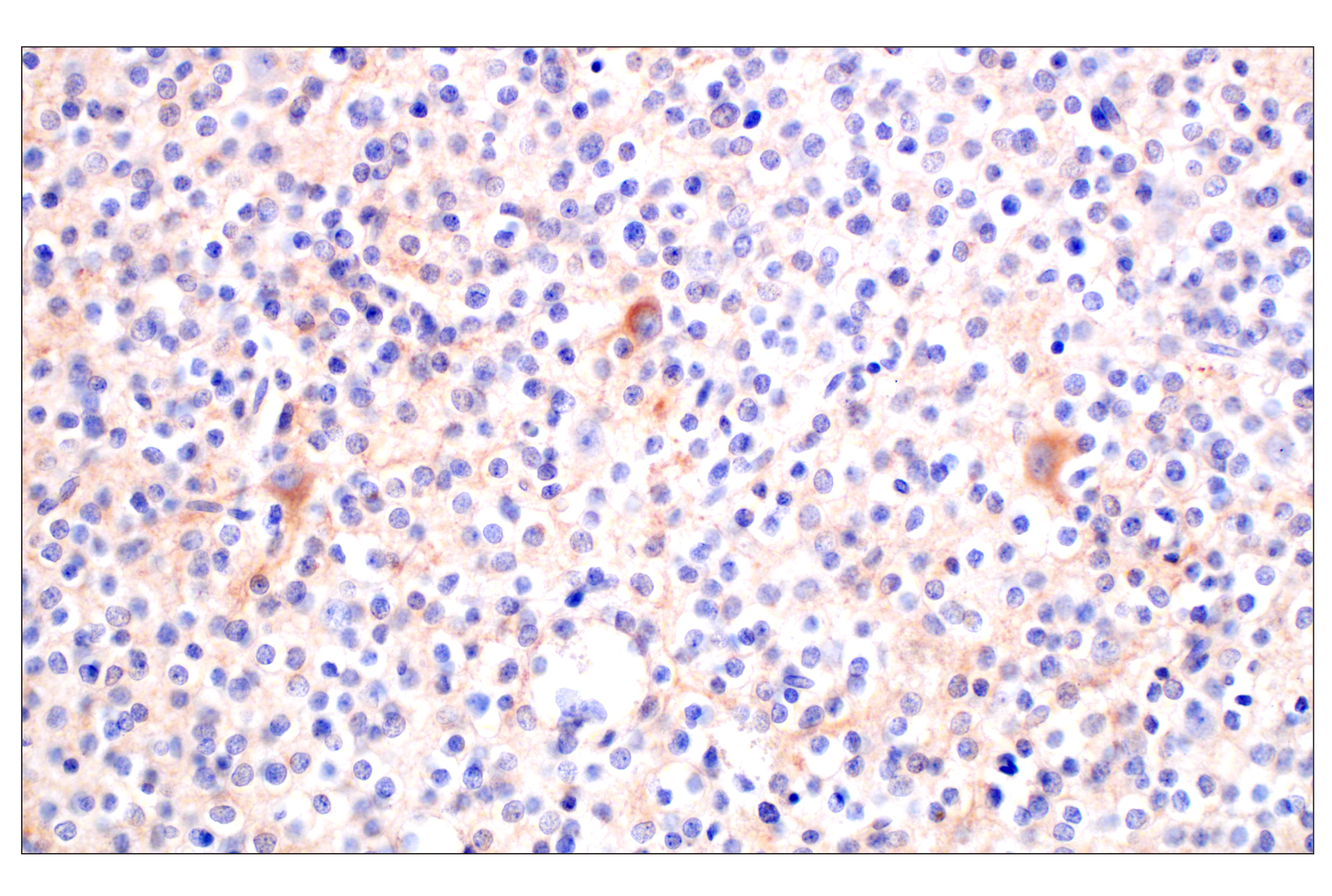 Immunohistochemistry Image 2: BACE1 (F4Z7X) Rabbit mAb