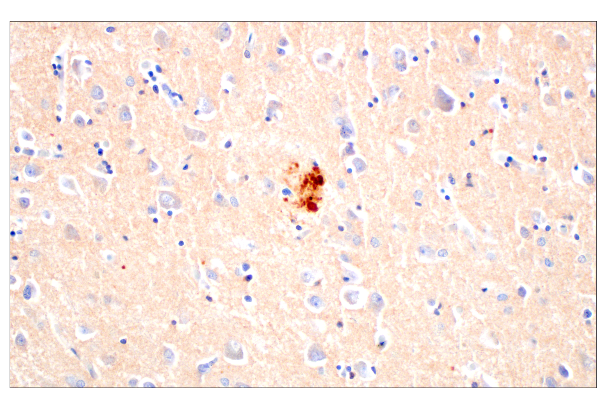 Immunohistochemistry Image 3: BACE1 (F4Z7X) Rabbit mAb