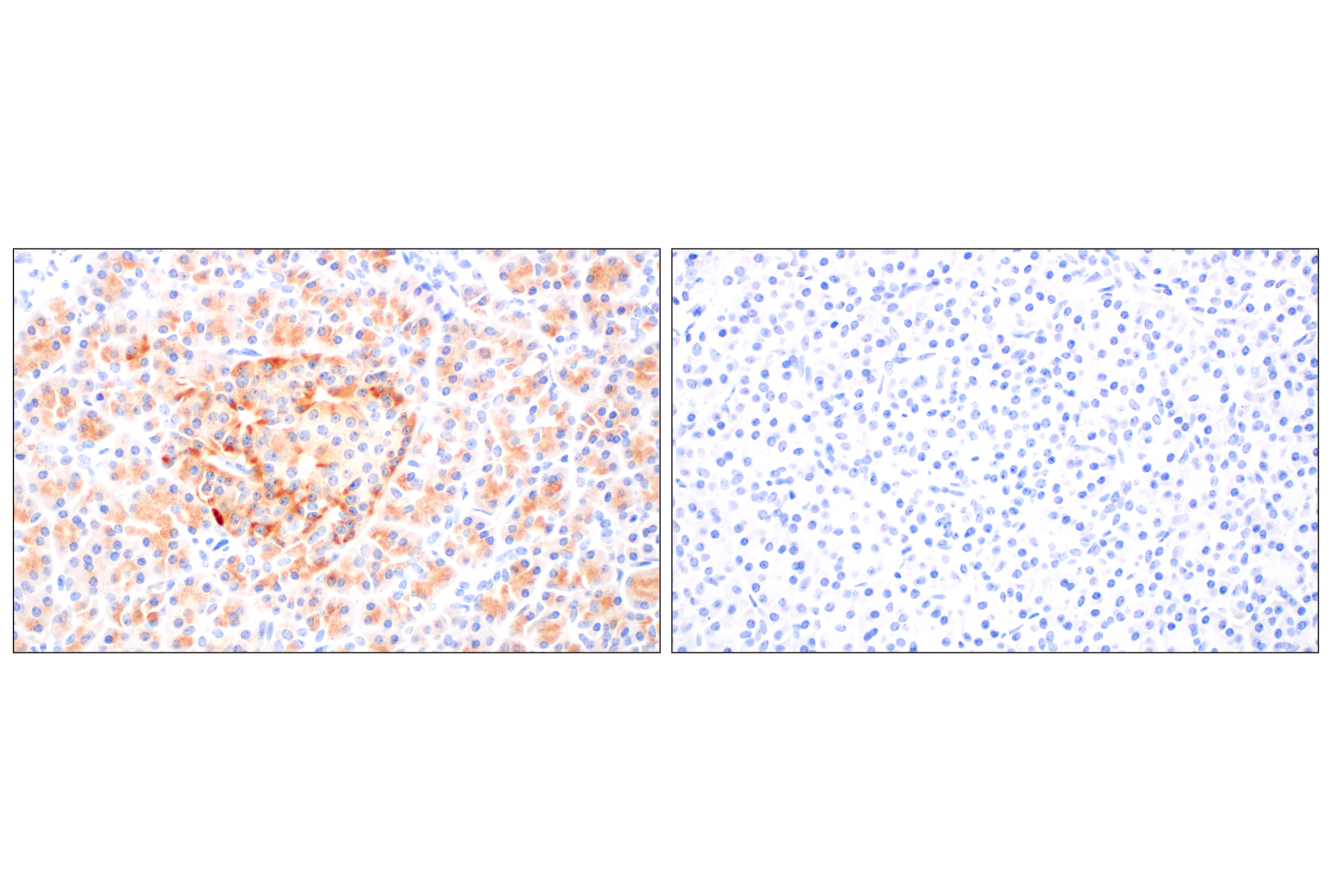 Immunohistochemistry Image 7: BACE1 (F4Z7X) Rabbit mAb