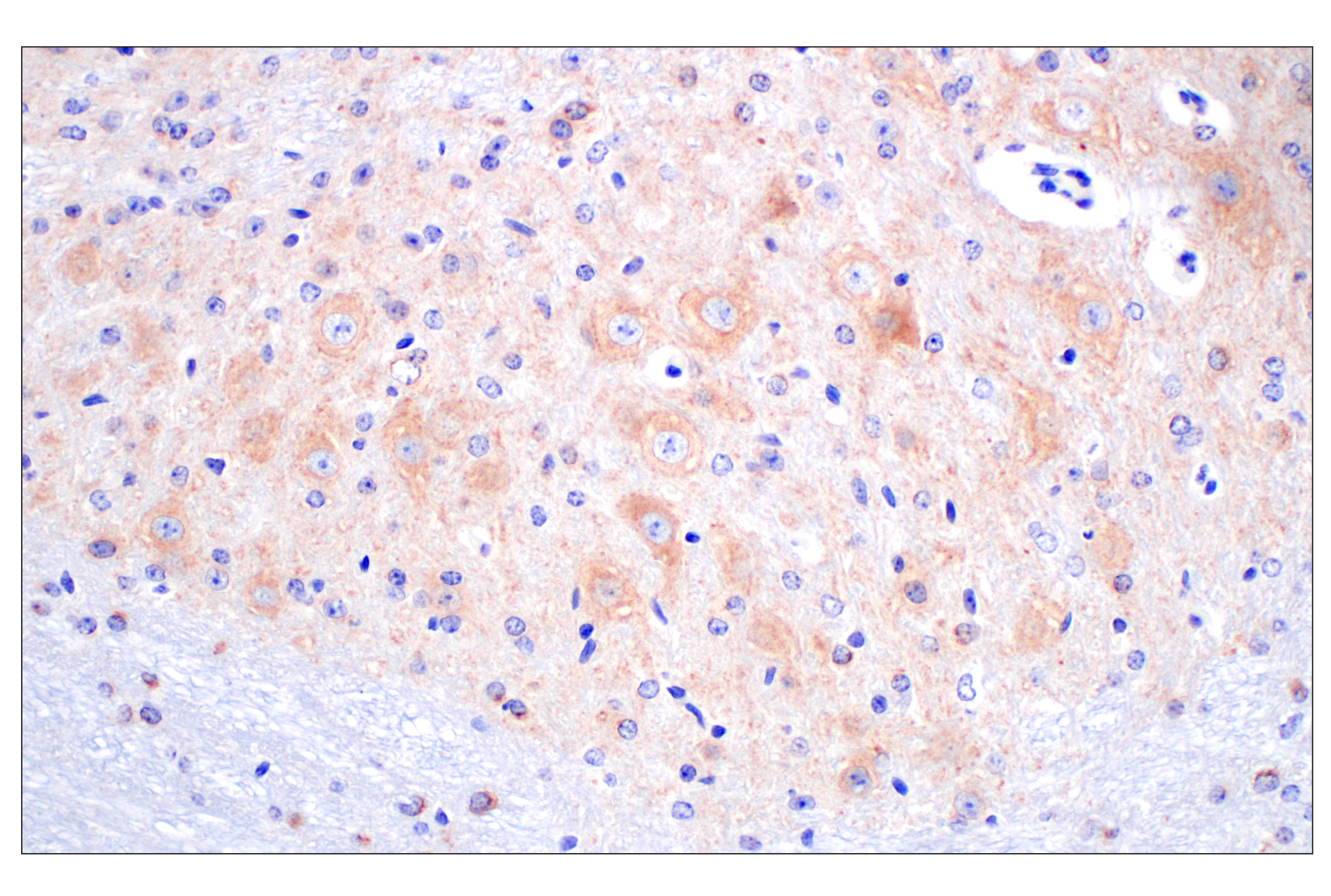 Immunohistochemistry Image 4: BACE1 (F4Z7X) Rabbit mAb
