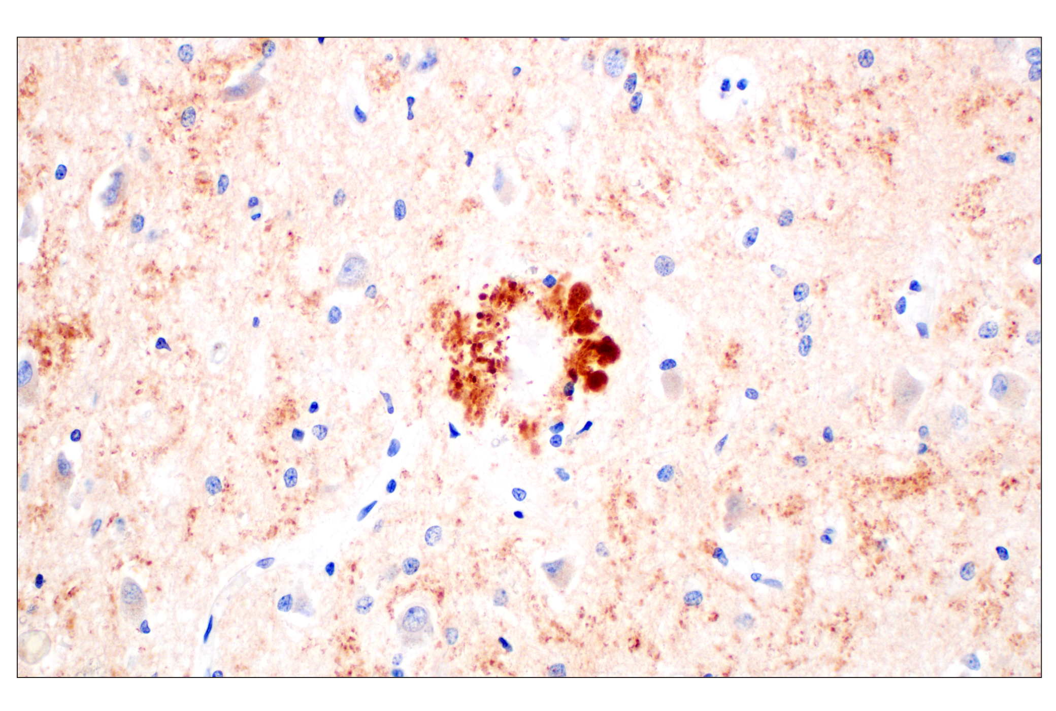 Immunohistochemistry Image 1: BACE1 (F4Z7X) Rabbit mAb