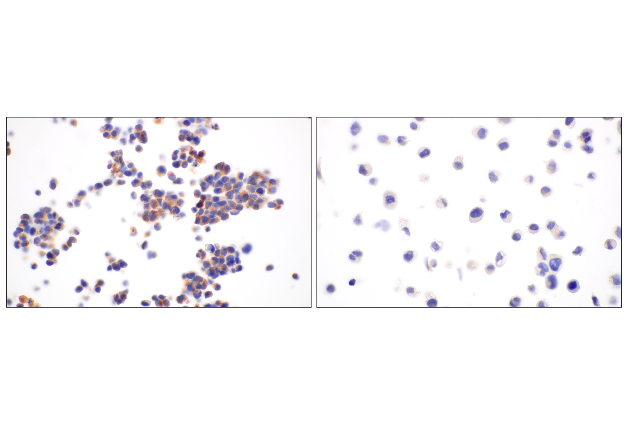 Immunohistochemistry Image 6: BACE1 (F4Z7X) Rabbit mAb