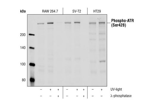 Western Blotting Image 1: Phospho-ATR (Ser428) Antibody