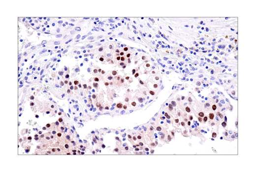 Immunohistochemistry Image 2: PAX8 (BC12) Mouse mAb