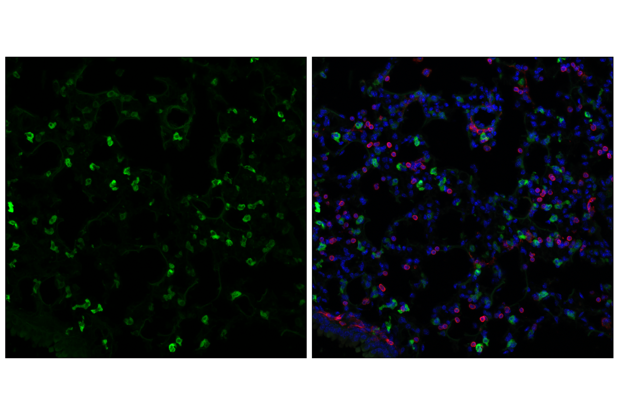 Immunofluorescence Image 1: SCD1 (C12H5) Rabbit mAb (Alexa Fluor® 488 Conjugate)