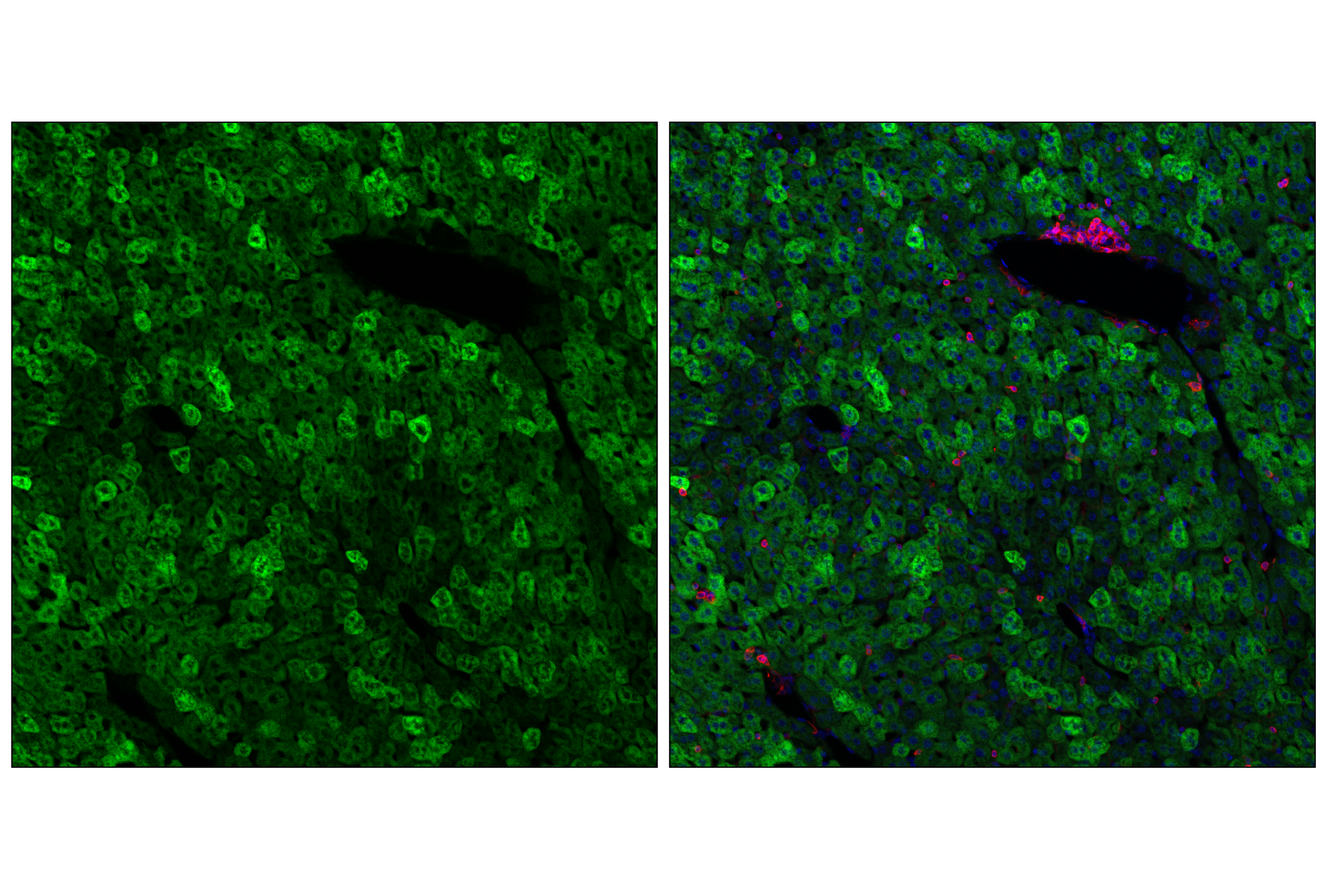 Immunofluorescence Image 2: SCD1 (C12H5) Rabbit mAb (Alexa Fluor® 488 Conjugate)