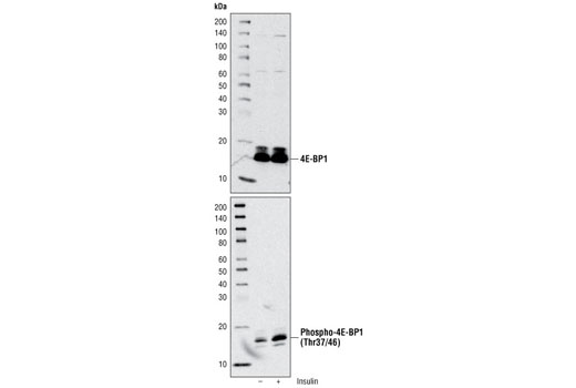  Image 1: mTOR Substrates Antibody Sampler Kit
