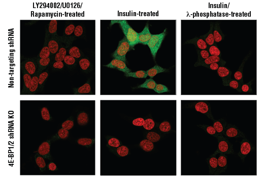 Immunofluorescence Image 1: Phospho-4E-BP1 (Thr37/46) (236B4) Rabbit mAb