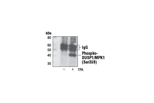 Immunoprecipitation Image 1: Phospho-DUSP1/MKP1 (Ser359) (125E2) Rabbit mAb