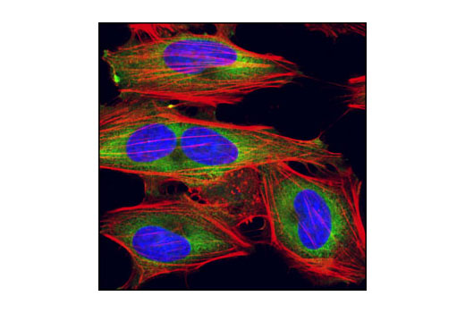 Immunofluorescence Image 1: eIF4GI Antibody