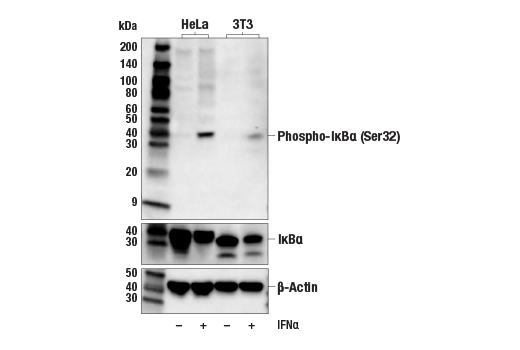 Western Blotting Image 1: Phospho-IκBα (Ser32) (14D4) Rabbit mAb