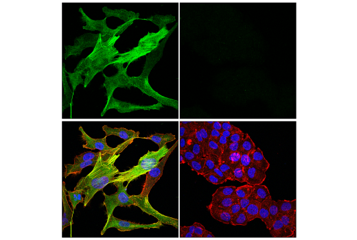 Immunofluorescence Image 1: CRP2 (E8R5N) Rabbit mAb