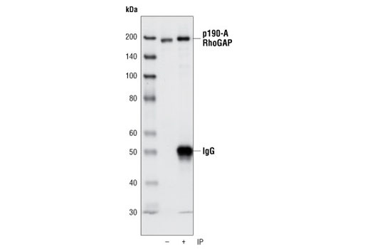 Immunoprecipitation Image 1: p190-A RhoGAP (C59F7) Rabbit mAb