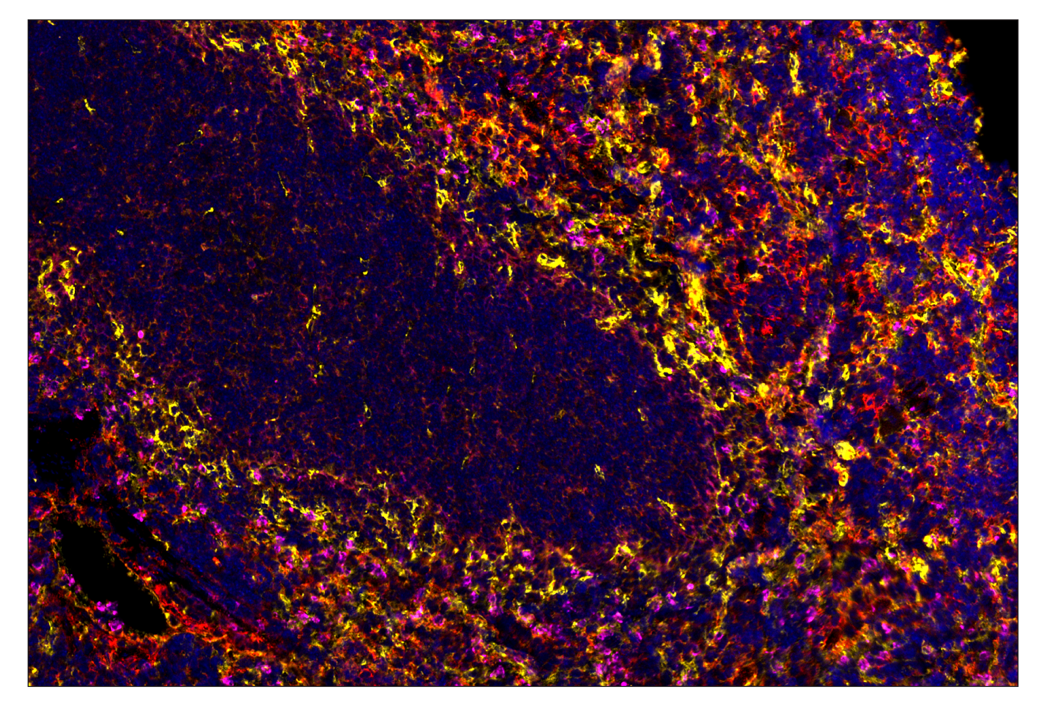 Immunohistochemistry Image 8: CD36 (E8B7S) & CO-0089-647 SignalStar™ Oligo-Antibody Pair