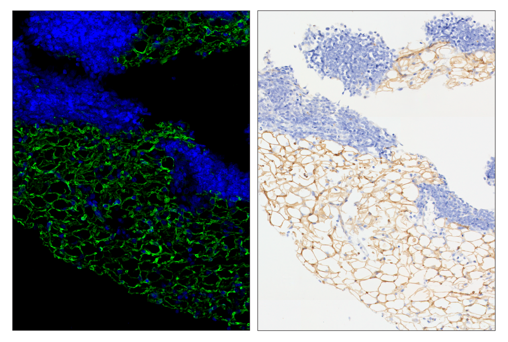 Immunohistochemistry Image 6: CD36 (E8B7S) & CO-0089-647 SignalStar™ Oligo-Antibody Pair