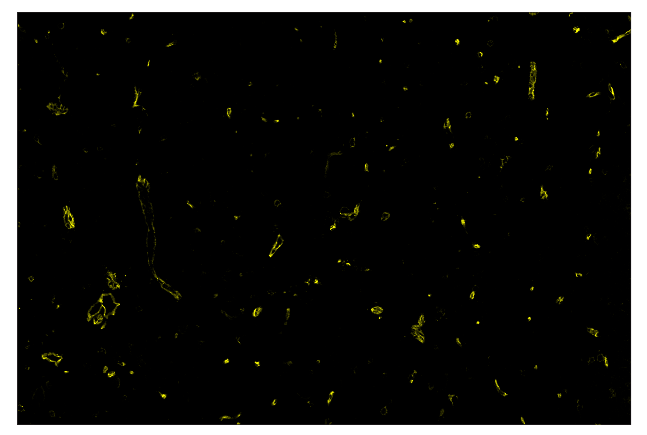 Immunohistochemistry Image 3: CD36 (E8B7S) & CO-0089-647 SignalStar™ Oligo-Antibody Pair