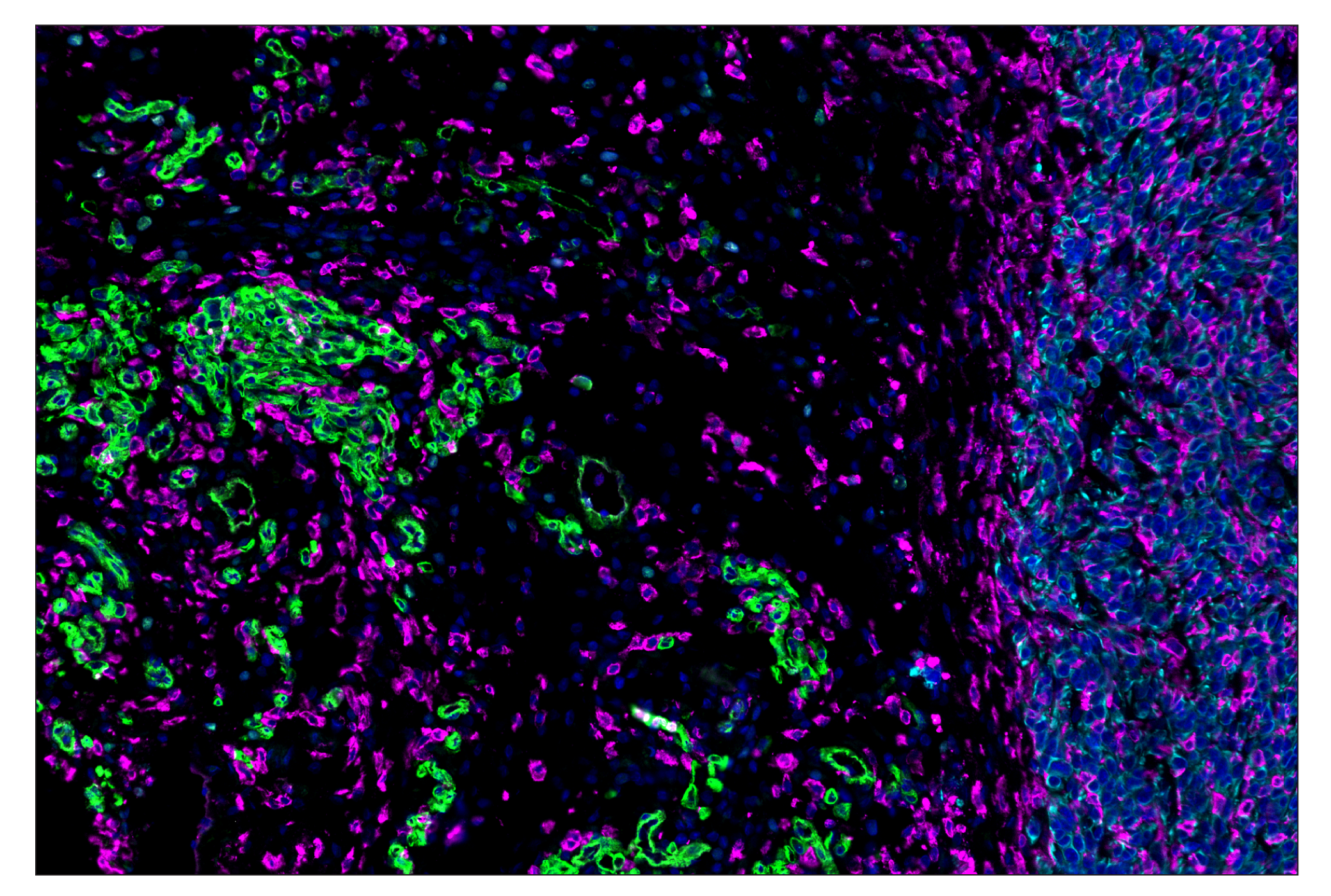 Immunohistochemistry Image 1: CD36 (E8B7S) & CO-0089-594 SignalStar™ Oligo-Antibody Pair