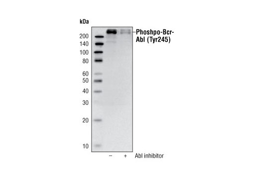 Western Blotting Image 1: Phospho-c-Abl (Tyr245) Antibody