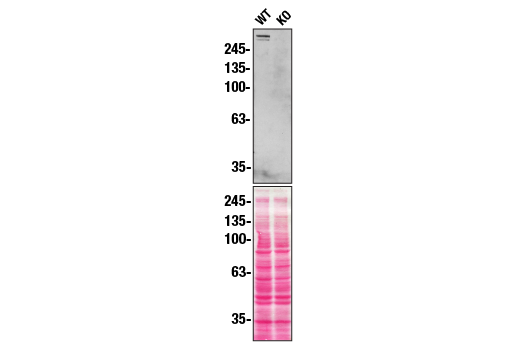 Western Blotting Image 2: Plectin-1 Antibody