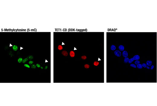 Immunofluorescence Image 1: 5-Methylcytosine (5-mC) (D3S2Z) Rabbit mAb
