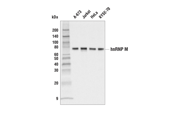 Western Blotting Image 1: hnRNP M Antibody