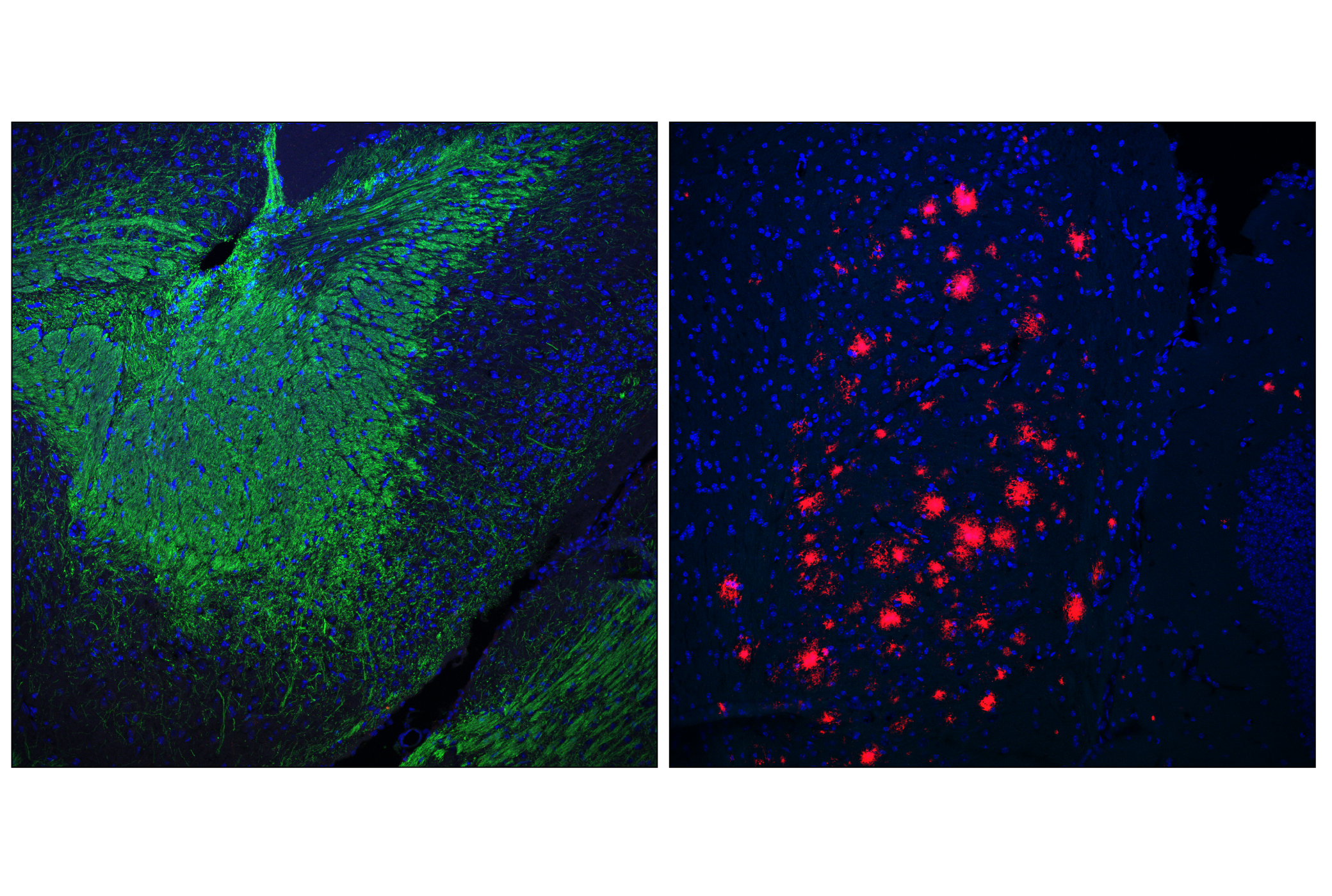 Immunofluorescence Image 1: PLP1 (E9V1N) Rabbit mAb