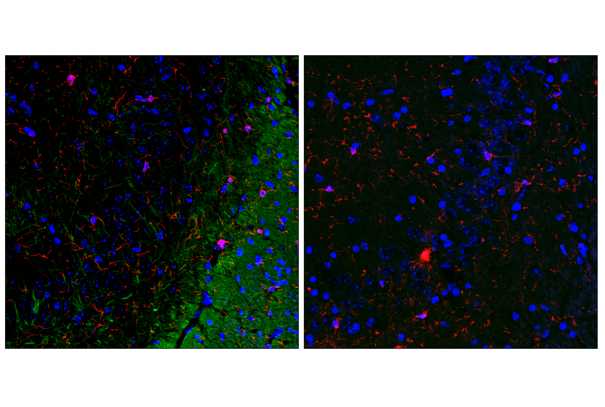 Immunofluorescence Image 2: PLP1 (E9V1N) Rabbit mAb