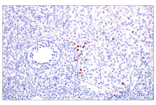 Immunohistochemistry Image 5: CD177 (E1V7N) Rabbit mAb