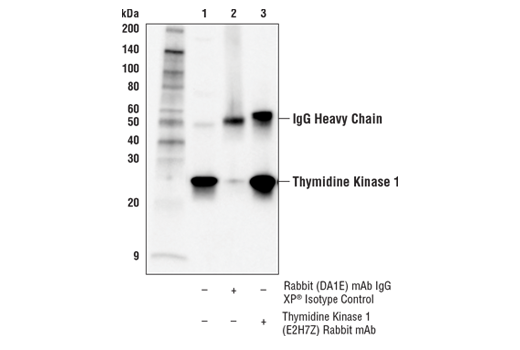  Image 12: Cell Cycle Phase Determination Antibody Sampler Kit