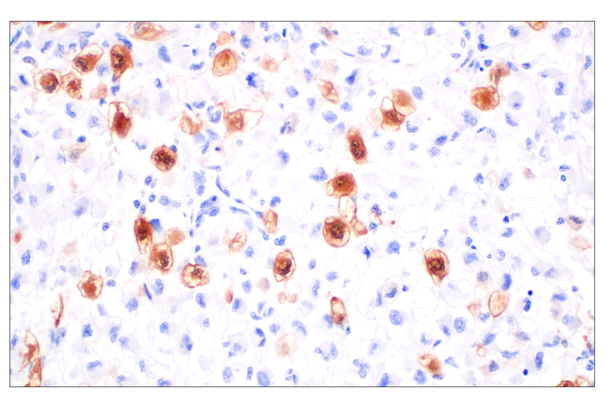  Image 35: Cell Cycle Phase Determination Antibody Sampler Kit