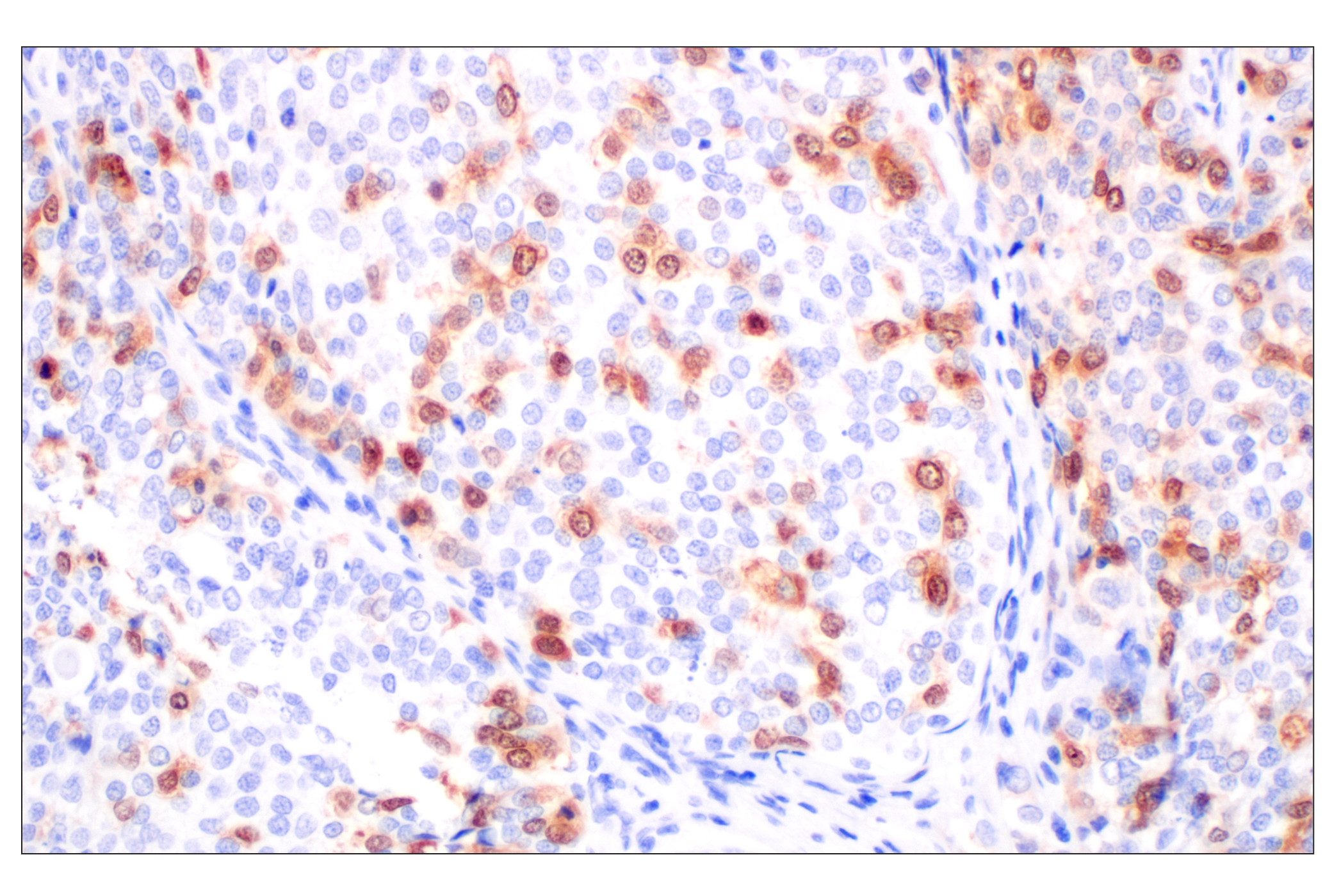  Image 33: Cell Cycle Phase Determination Antibody Sampler Kit