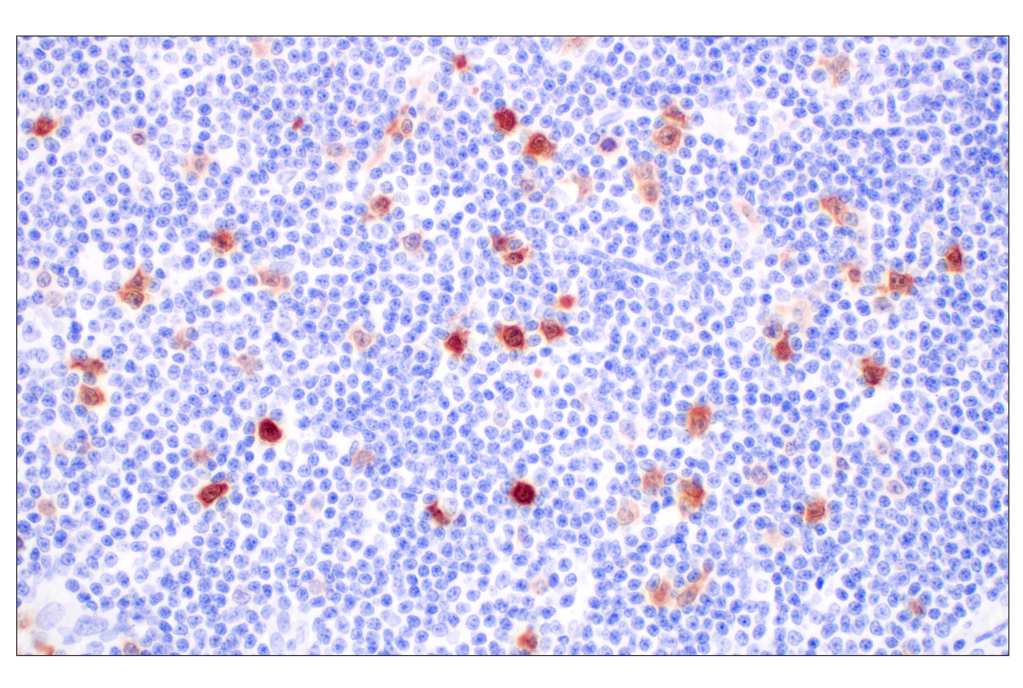  Image 28: Cell Cycle Phase Determination Antibody Sampler Kit