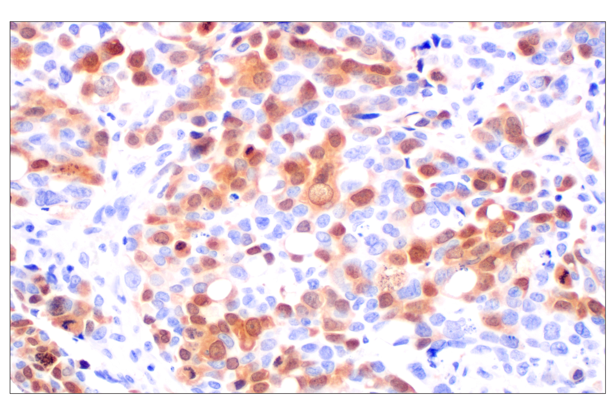  Image 6: Cell Cycle Phase Determination Antibody Sampler Kit