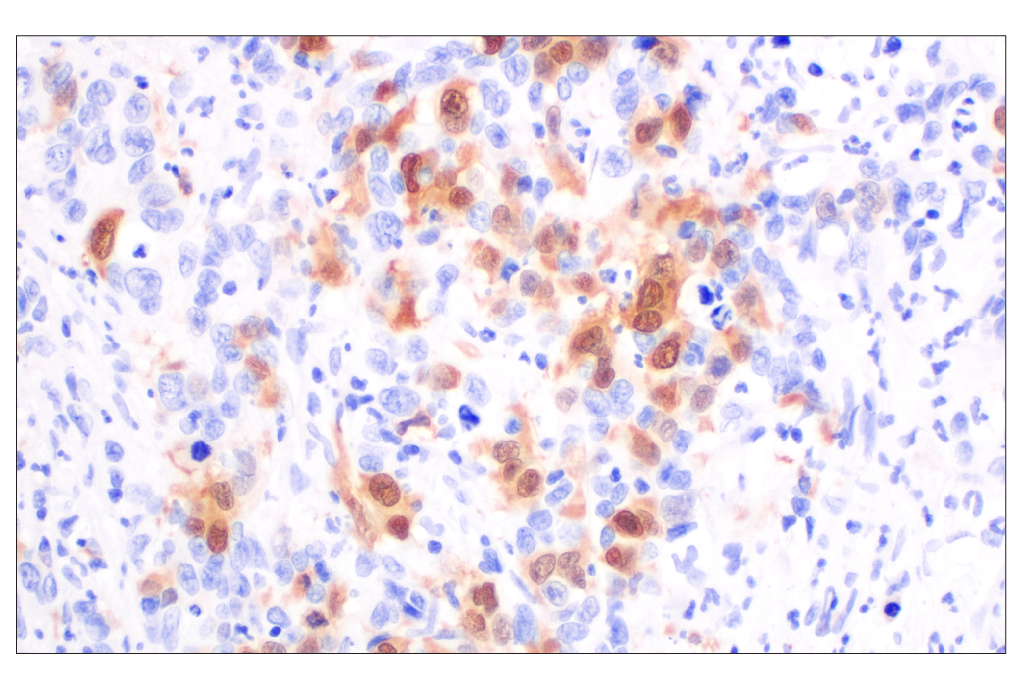  Image 16: Cell Cycle Phase Determination Antibody Sampler Kit