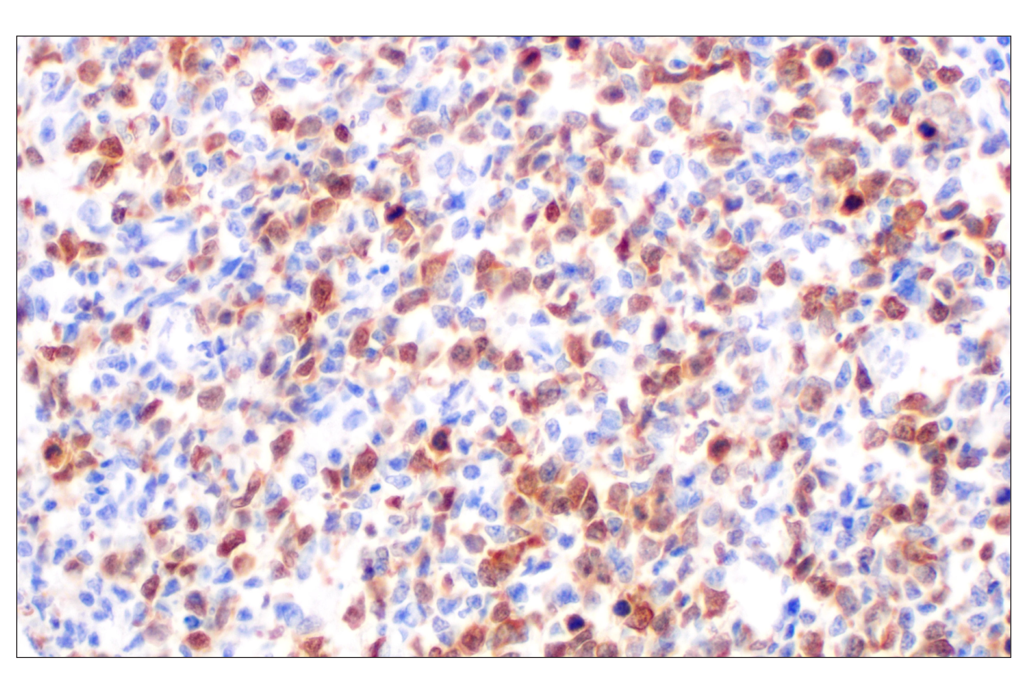  Image 37: Cell Cycle Phase Determination Antibody Sampler Kit