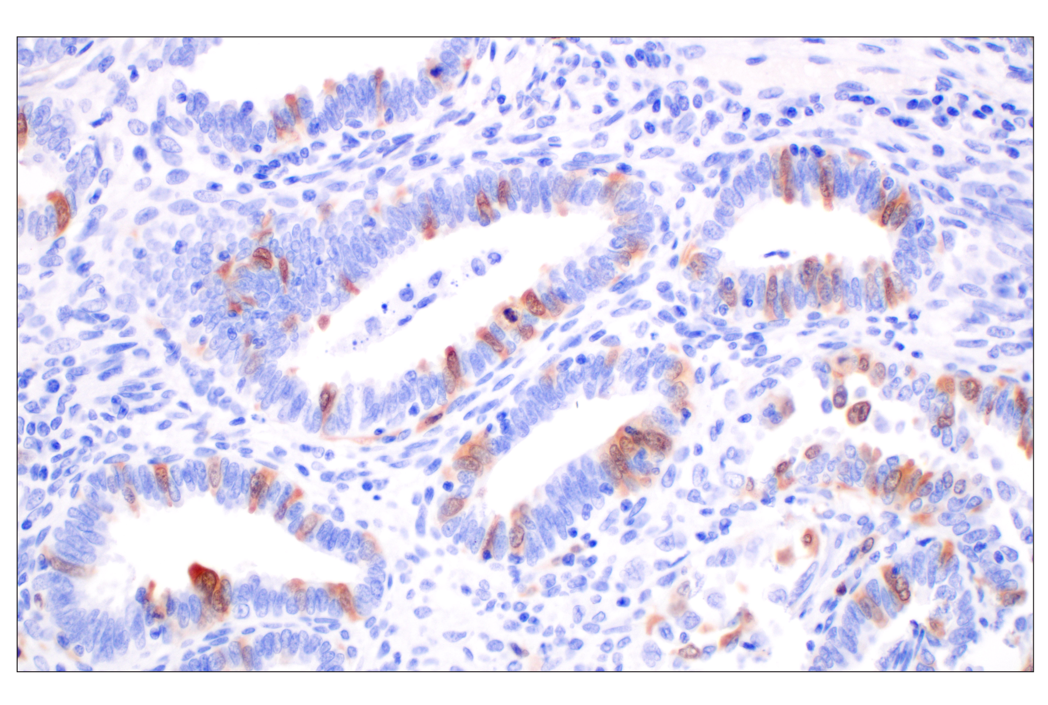  Image 23: Cell Cycle Phase Determination Antibody Sampler Kit