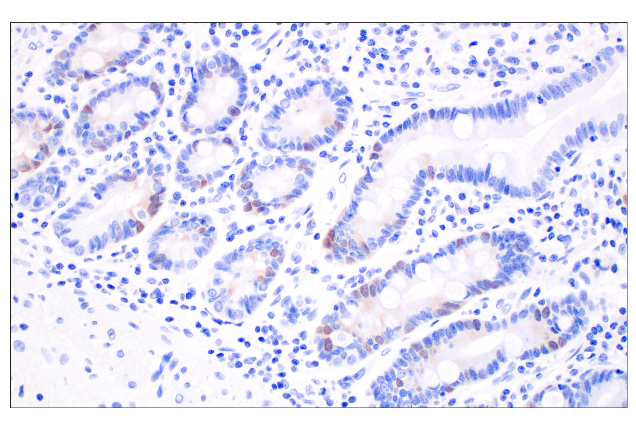  Image 40: Cell Cycle Phase Determination Antibody Sampler Kit