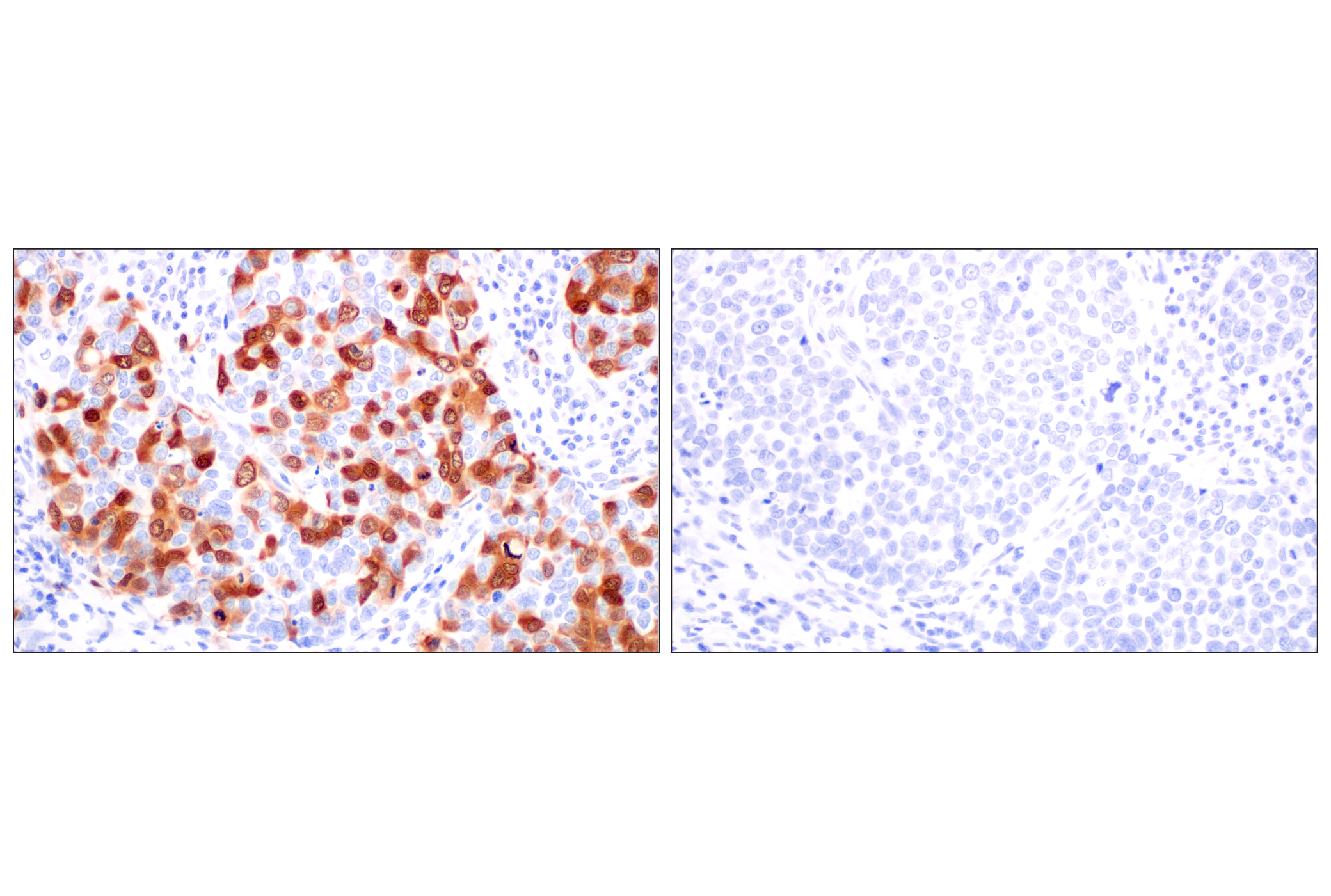  Image 42: Cell Cycle Phase Determination Antibody Sampler Kit