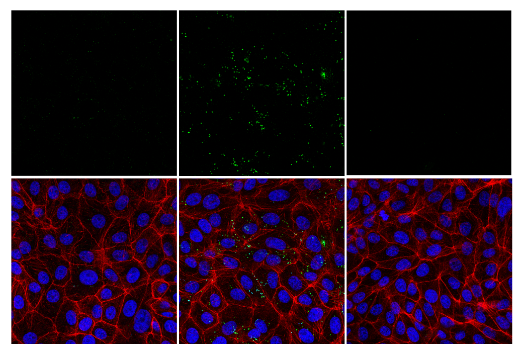 Immunofluorescence Image 1: dsRNA (K1) Mouse mAb