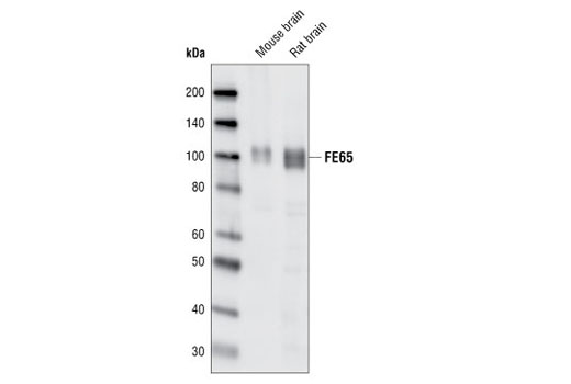 Western Blotting Image 2: FE65 Antibody