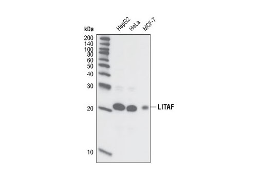 Western Blotting Image 1: LITAF Antibody