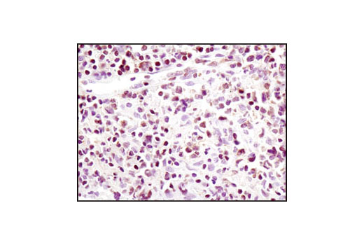 Immunohistochemistry Image 1: FoxO1 (C29H4) Rabbit mAb (BSA and Azide Free)