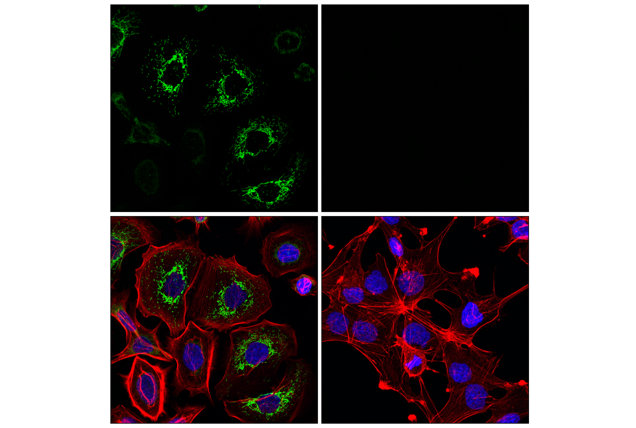 Immunofluorescence Image 1: GATM (F6S8W) Rabbit mAb