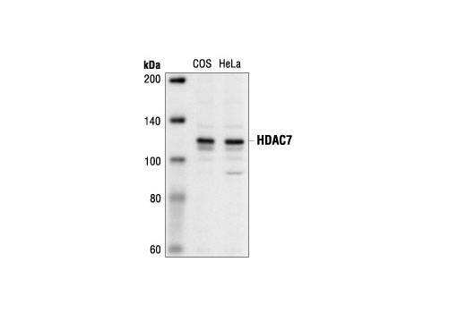 Western Blotting Image 1: Histone Deacetylase 7 (HDAC7) Antibody